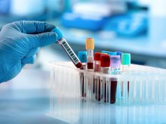 Un test sanguin révolutionnaire : détecter 25 types de cancer avant leur formation Un test sanguin révolutionnaire : détecter 25 types de cancer avant leur formation